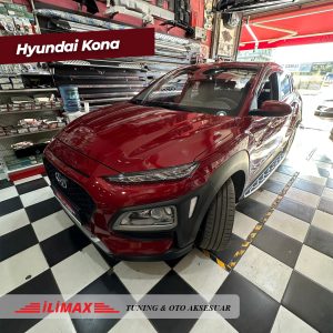 ilimax-otomotiv-hyundai-kona